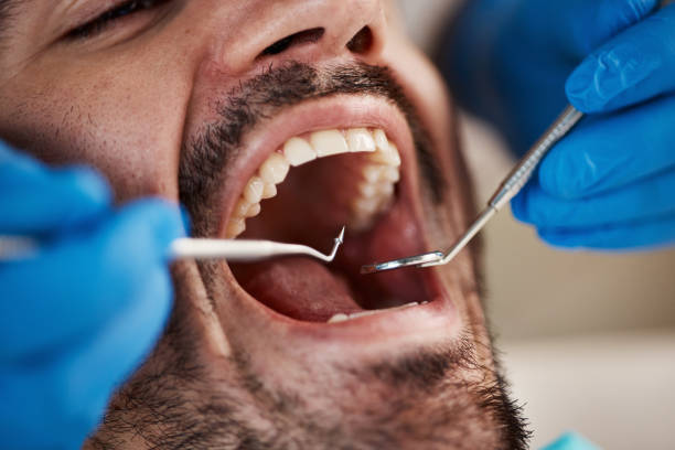 Best Chipped Tooth Repair Near Me  in West Lafayette, IN